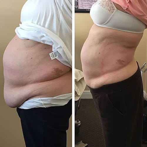 Ideal-Weight-Loss-Patient-Testimonial-01 Ideal Weight Loss Patient Testimonial