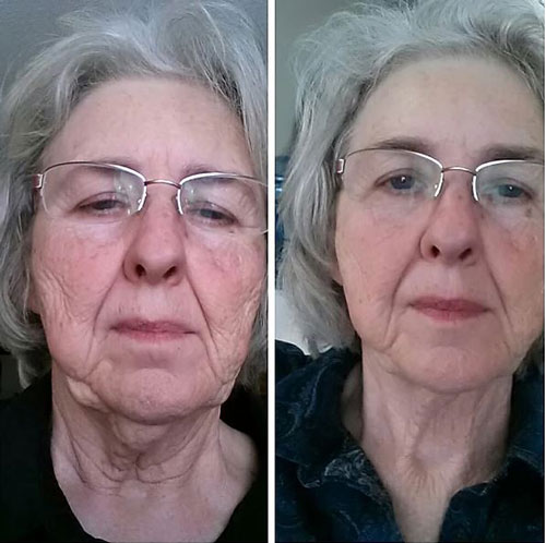 Ideal-Weight-Loss-Patient-Testimonial-02 Ideal Weight Loss Patient Testimonial