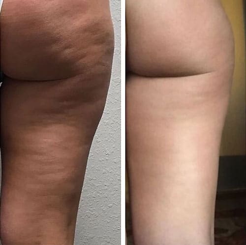 Ideal-Weight-Loss-Patient-Testimonial-04 Ideal Weight Loss Patient Testimonial